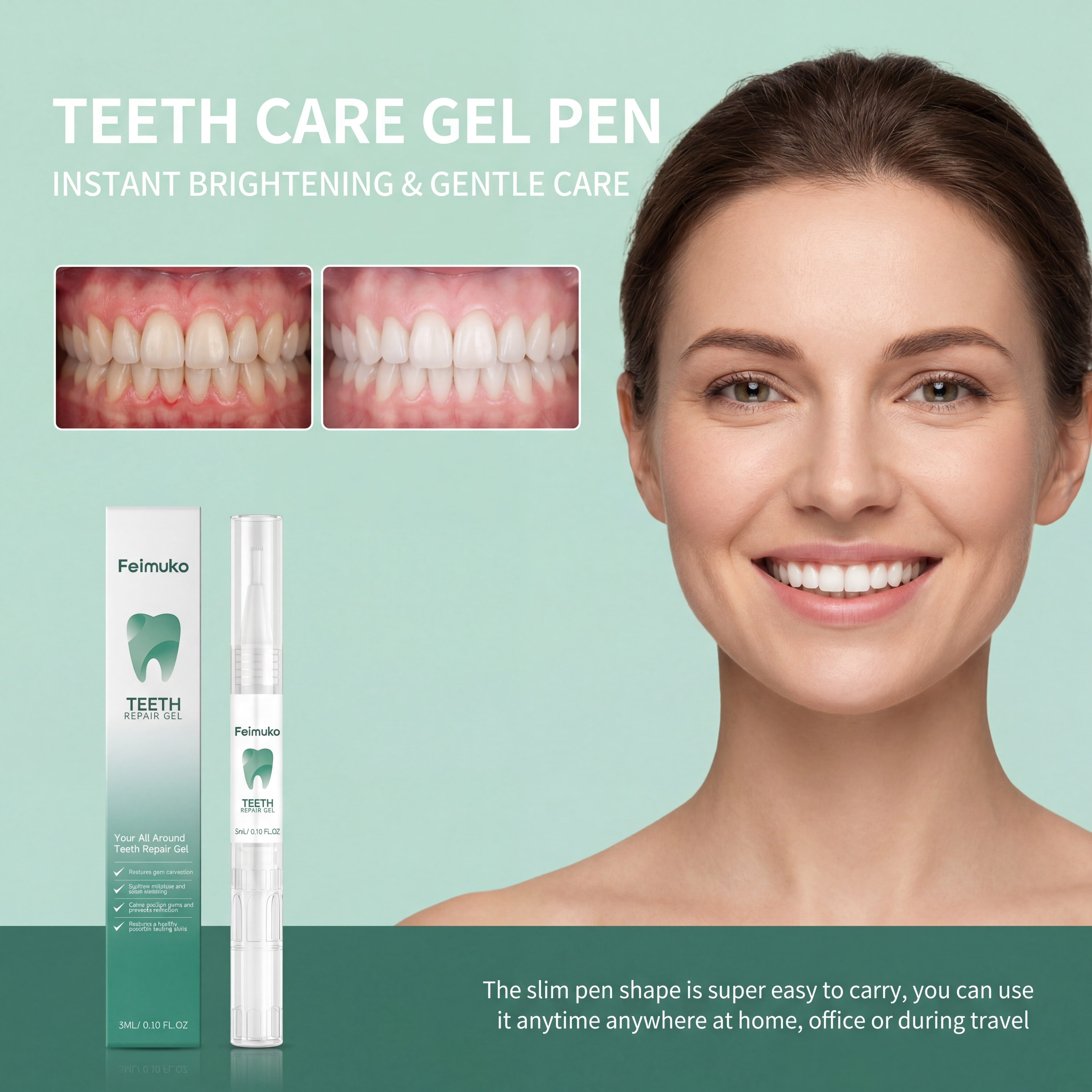 Teeth Whitening Gel Pen - 1/2/3/4/5/8/10Pcs Mild Teeth Care Gel Pen