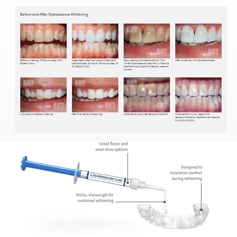 Opalescence Whitening 20% PF 2 - Teeth Whitening Home Kit avaliação e preço