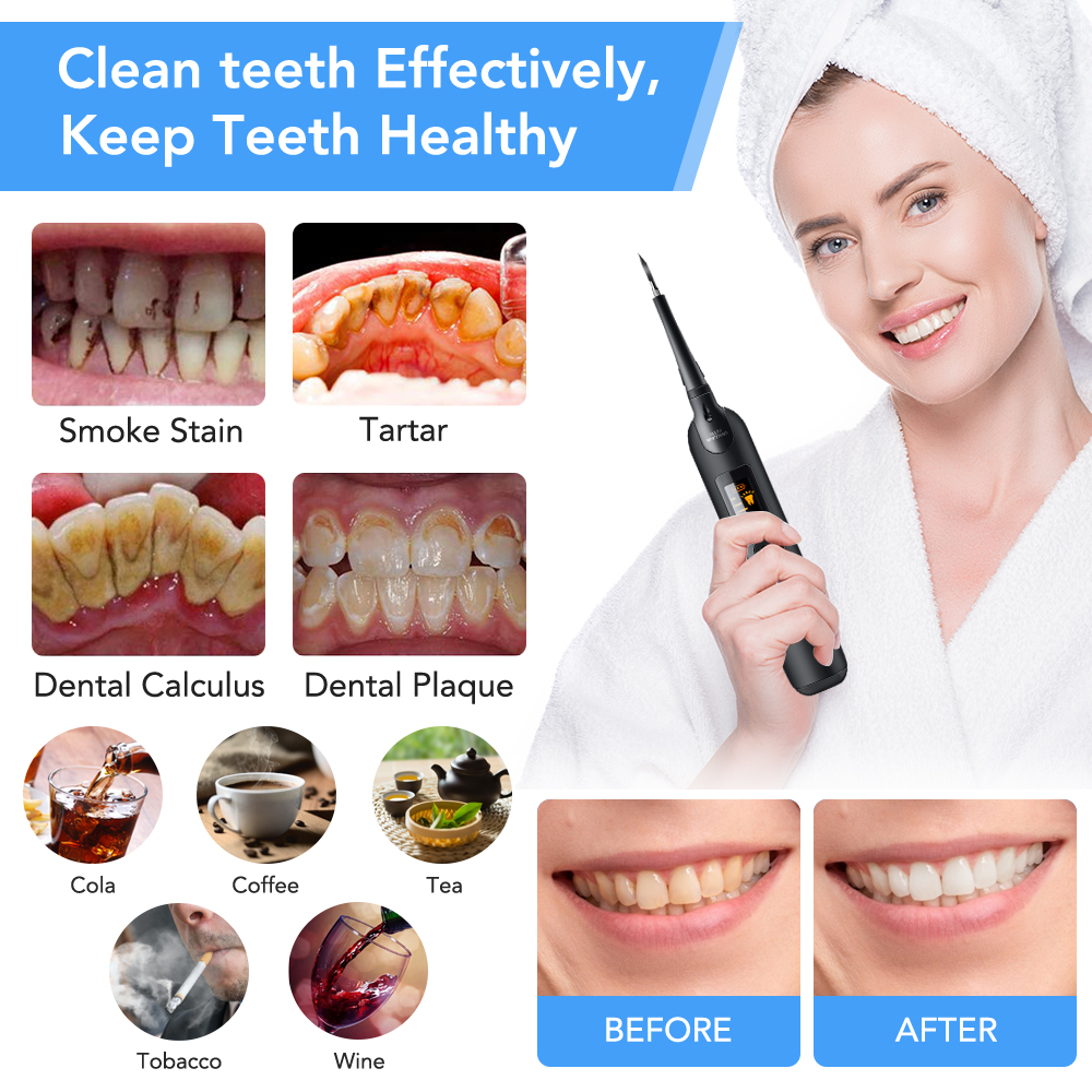 Teeth Tartar Remover Electric  - Teeth Whitening Home Kit avaliação e preço