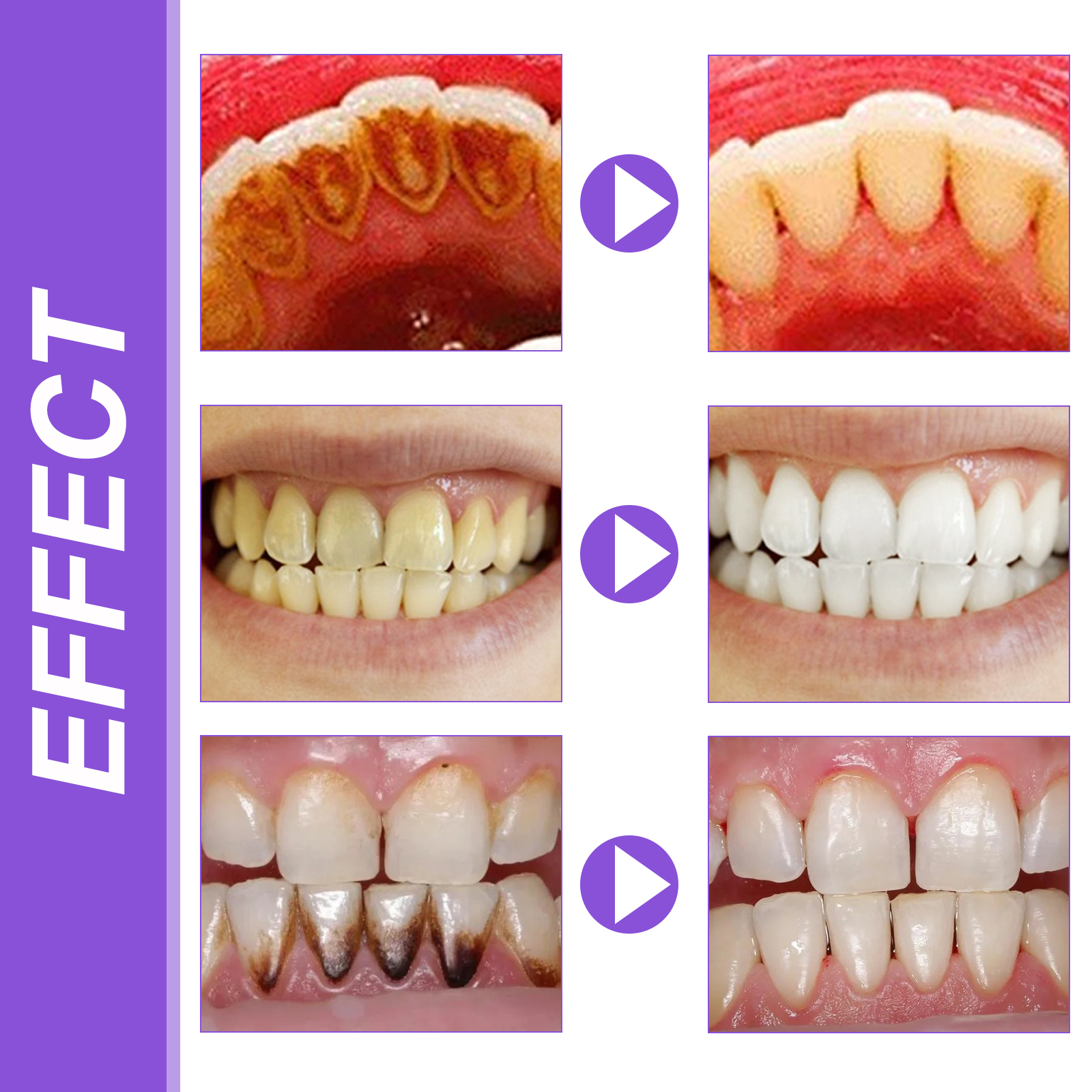 EELHOE Smiles Bright White Ref - Teeth Whitening Serum avaliação e preço