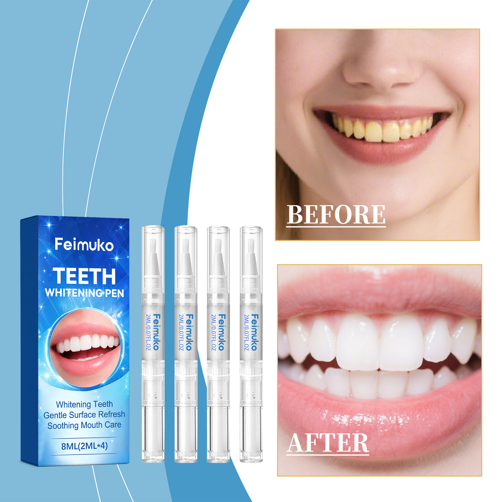 Feimuko 8ml Teeth Gel Pen Gent - Teeth Whitening Gel Pen avaliação e preço