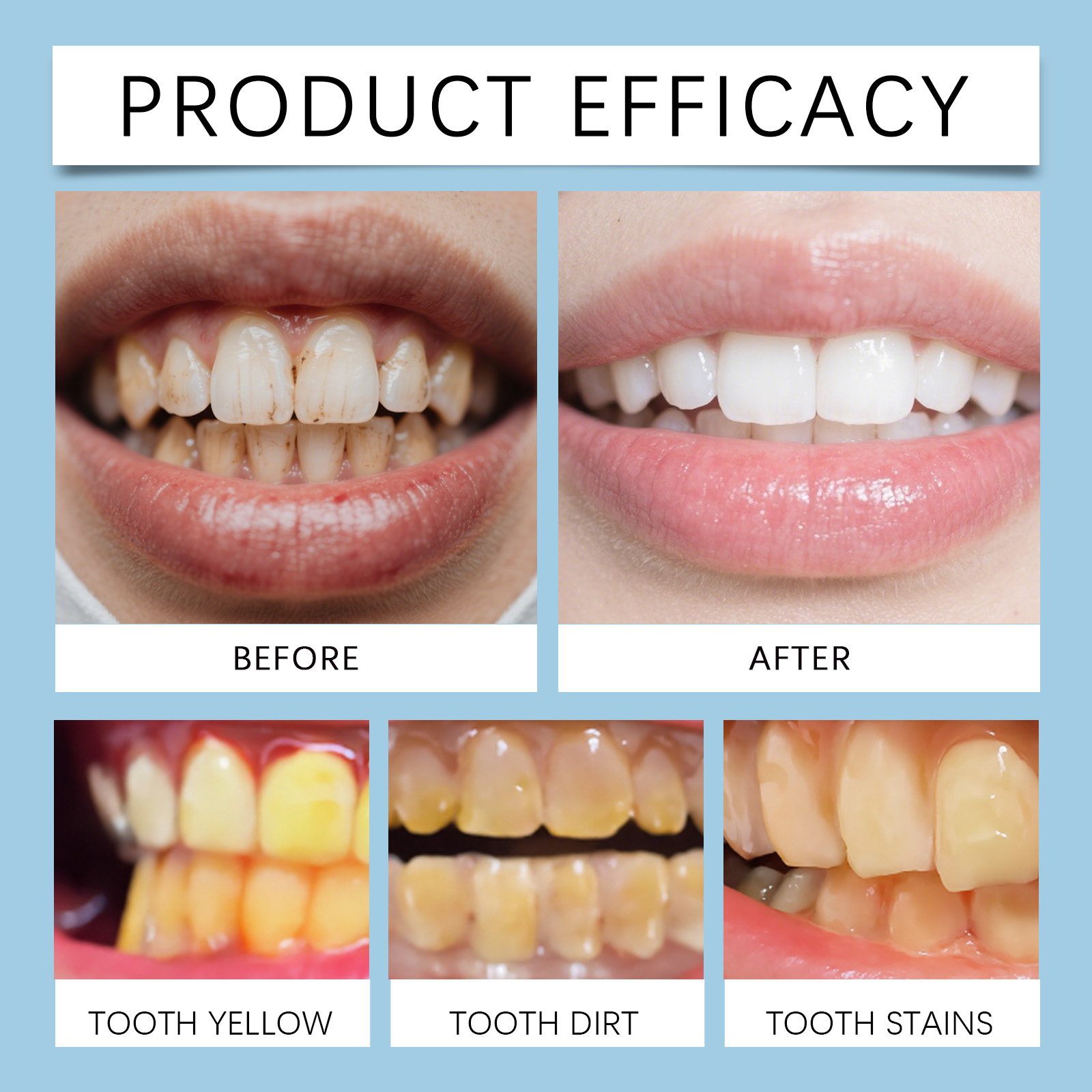 Feimuko 8ml Teeth Gel Pen Gent - Teeth Whitening Gel Pen avaliação e preço