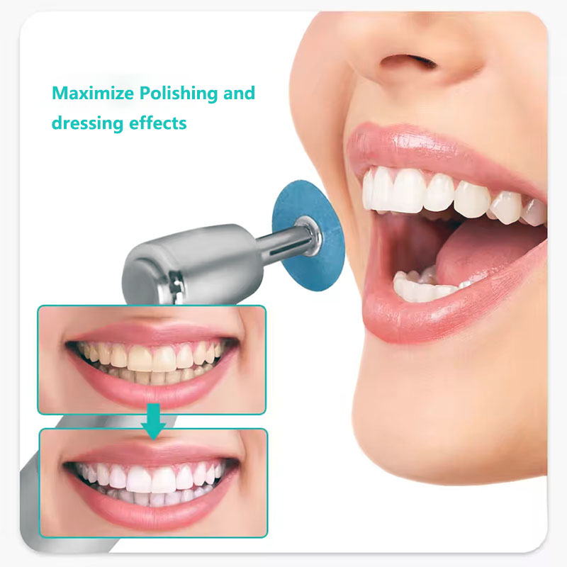 40pcs Dental Polishing Discs H - Teeth Whitening Kit Professional avaliação e preço
