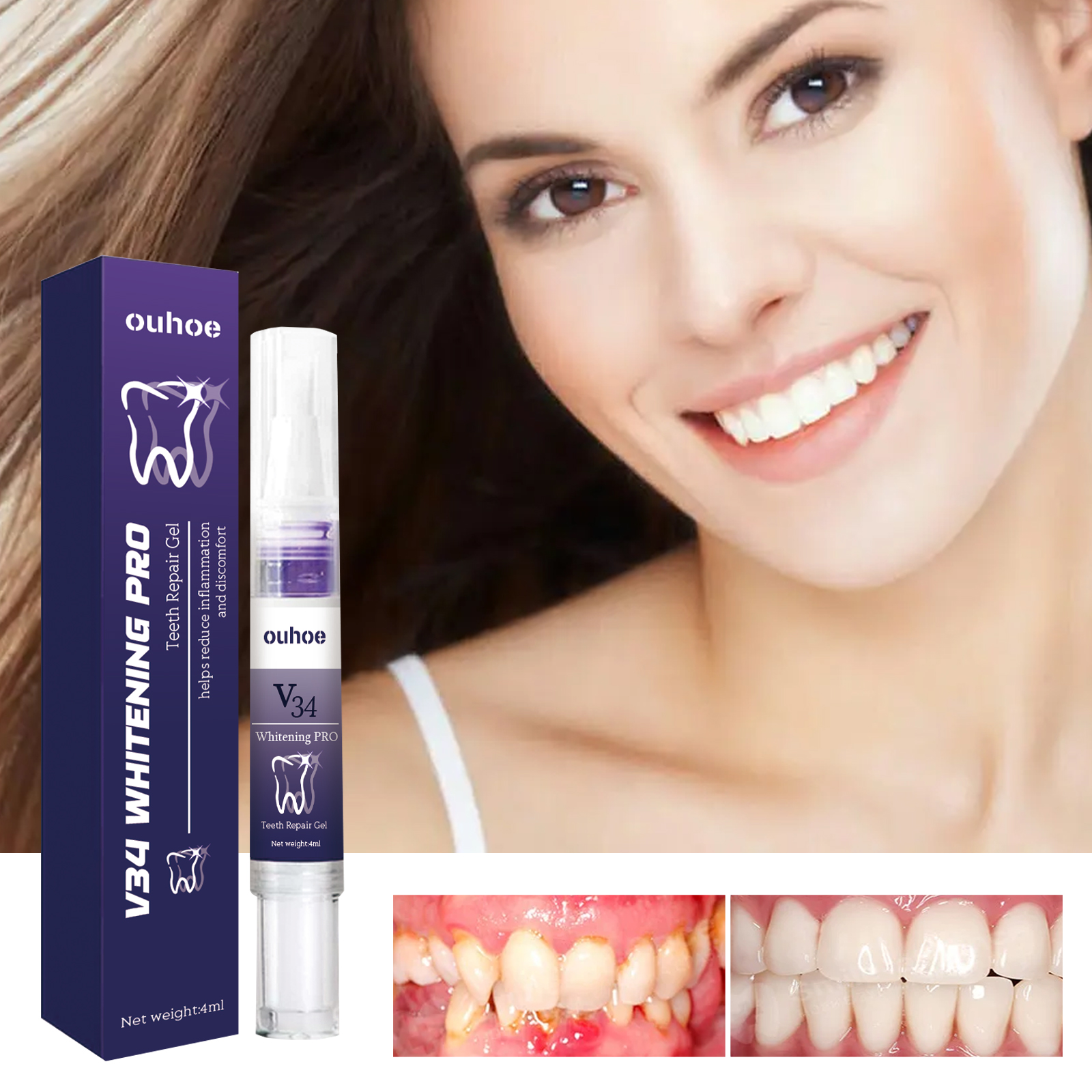 Rapid Repair Damaged Gums Gel  - Teeth Whitening Serum avaliação e preço