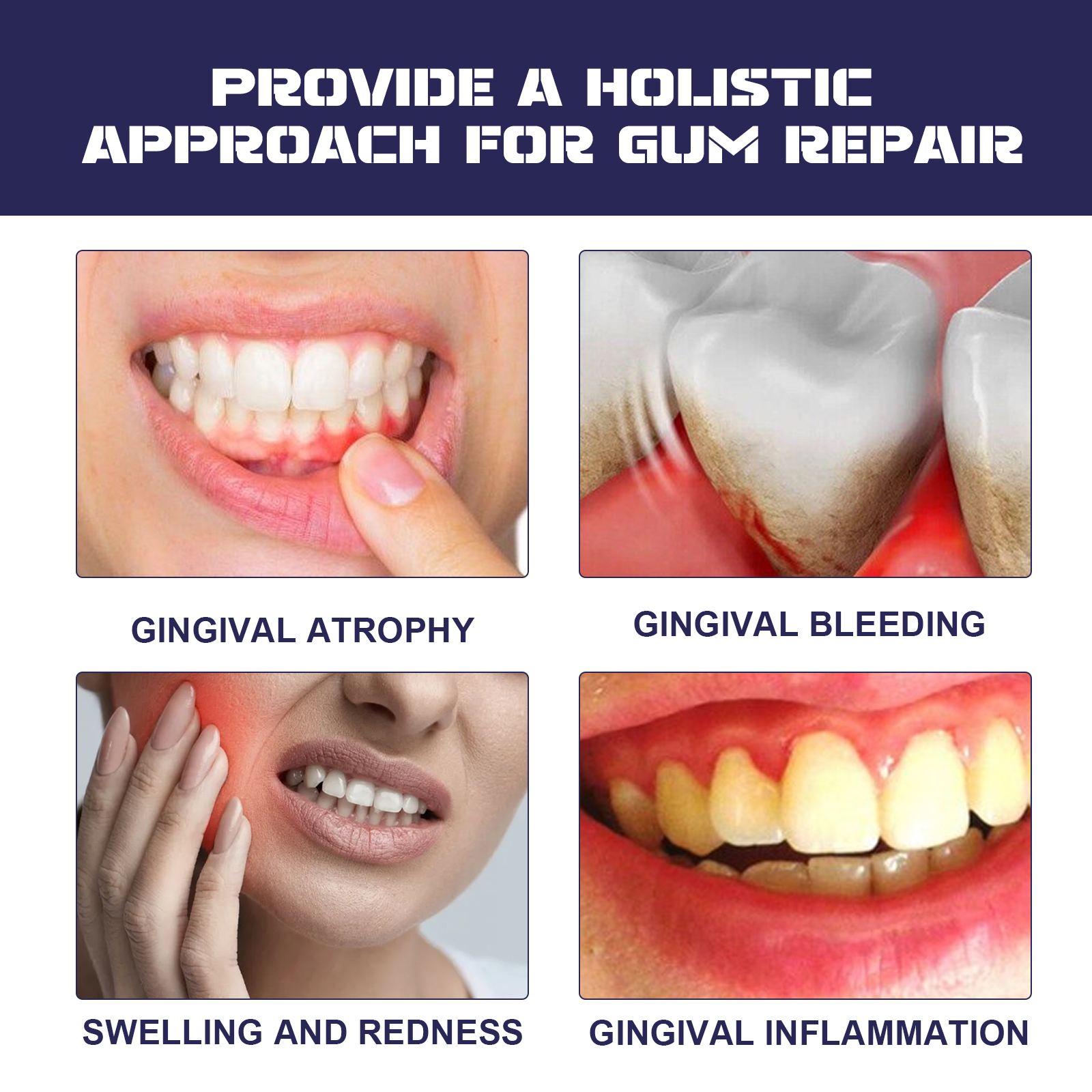 Rapid Repair Damaged Gums Gel  - Teeth Whitening Serum avaliação e preço