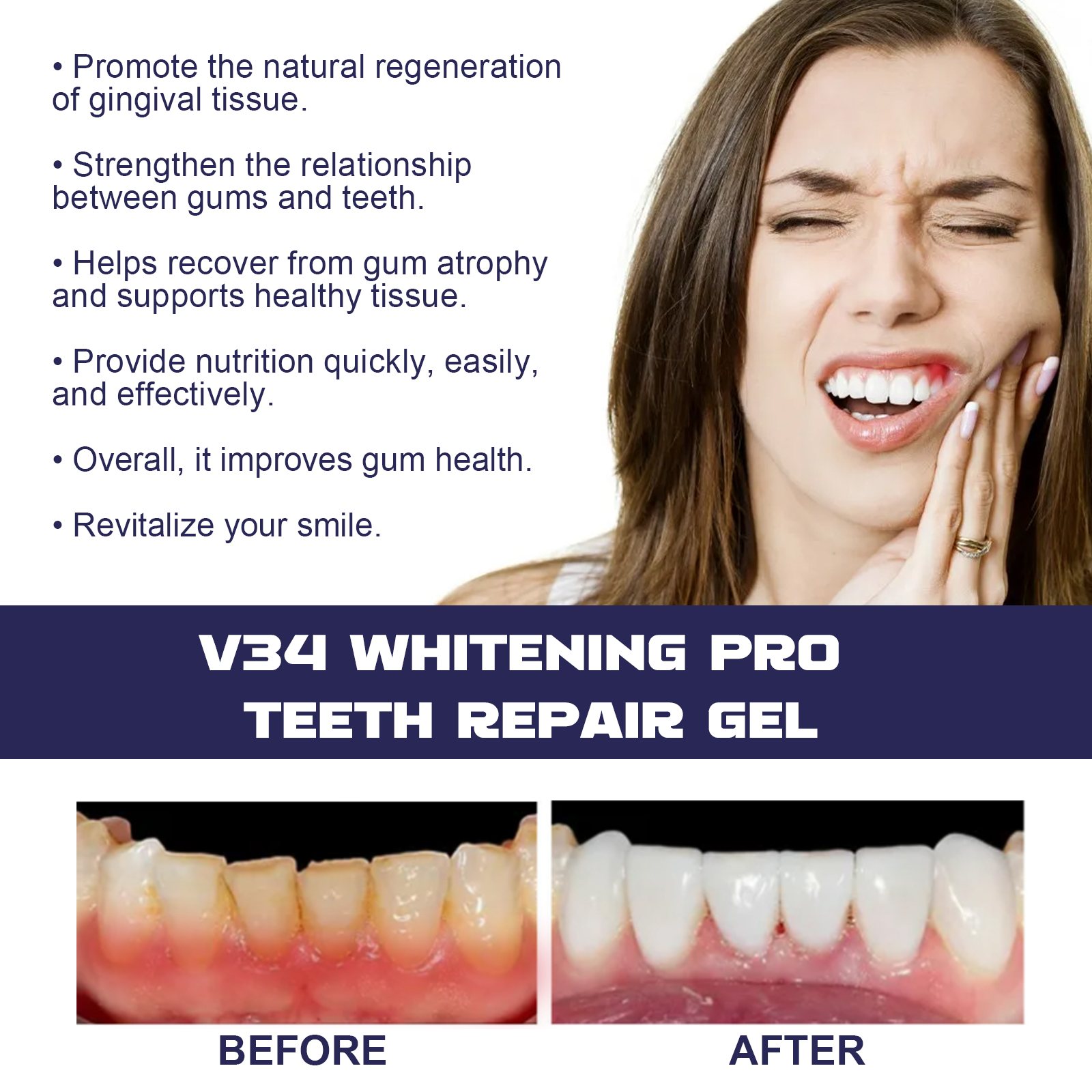 Rapid Repair Damaged Gums Gel  - Teeth Whitening Serum avaliação e preço