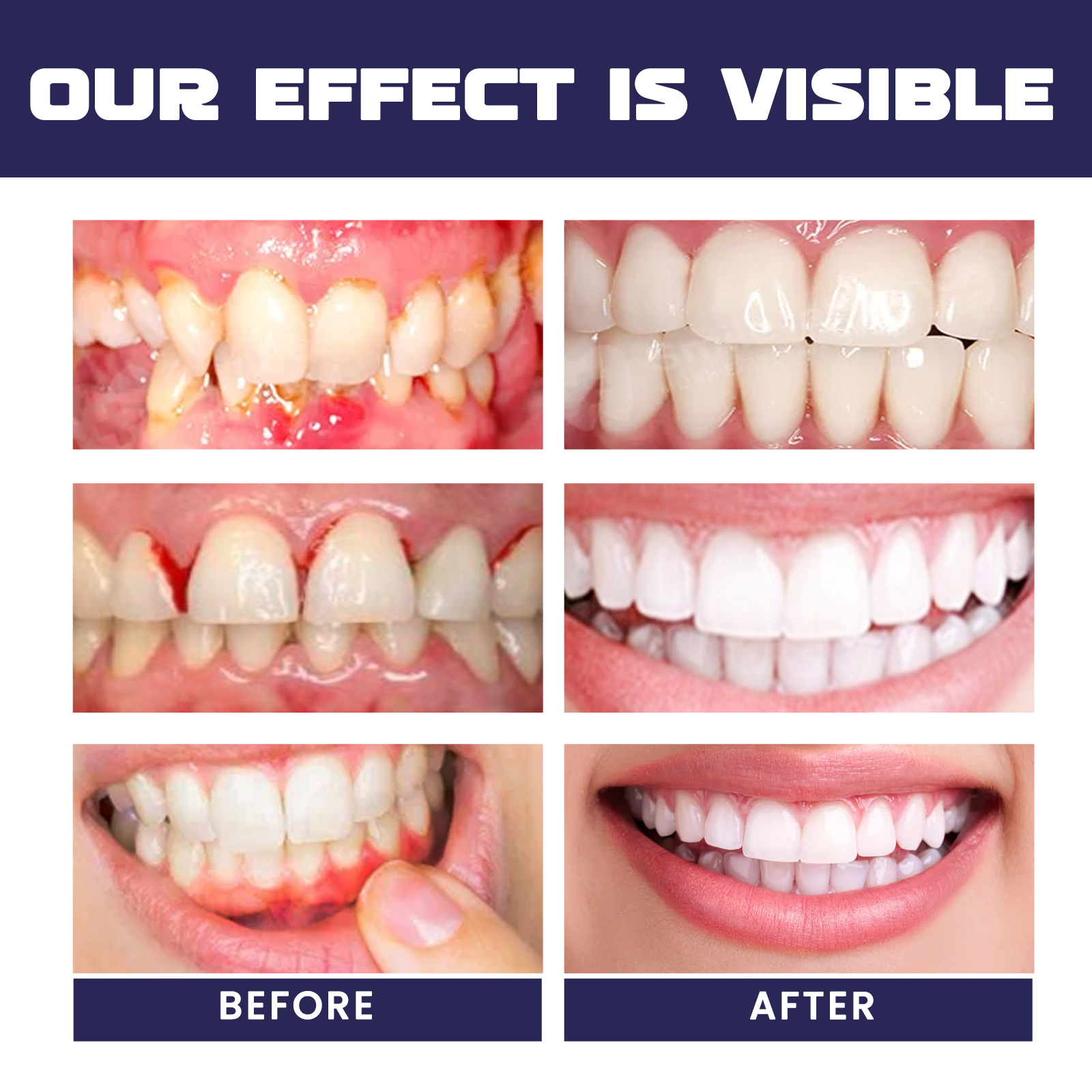 Rapid Repair Damaged Gums Gel  - Teeth Whitening Serum avaliação e preço