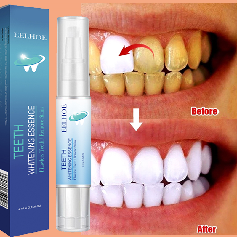 Teeth Whitening Pen Dental Ess - Teeth Whitening Serum avaliação e preço