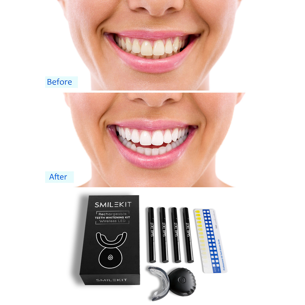 New Electric Teeth Whitening L - Teeth Whitening Home Kit avaliação e preço