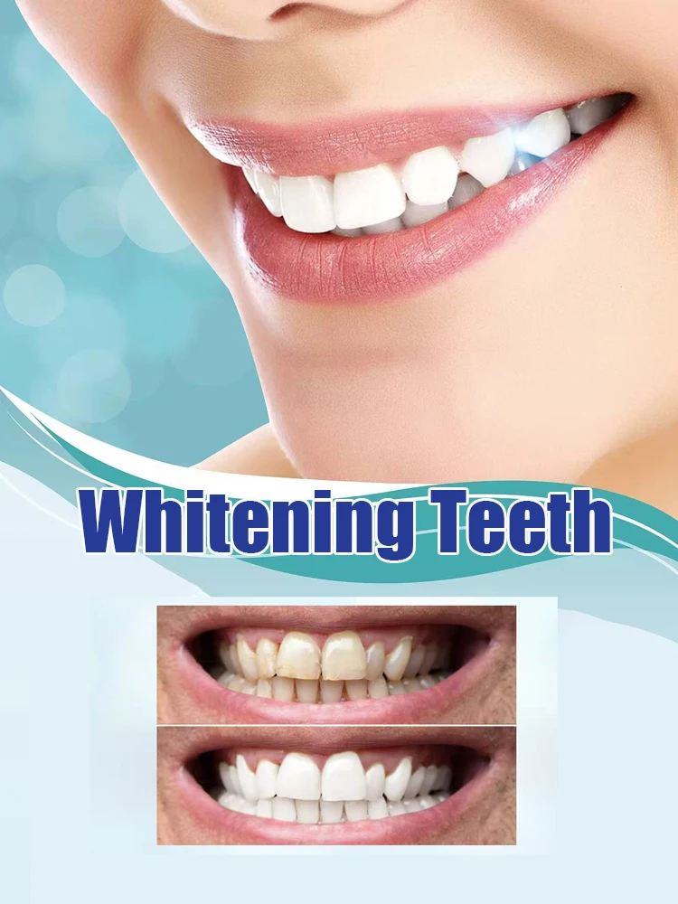 2Nd Upgraded Teeth Whitening T - Teeth Whitening Serum avaliação e preço